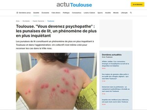 Journal Actu Toulouse Punaises de lit SNA
